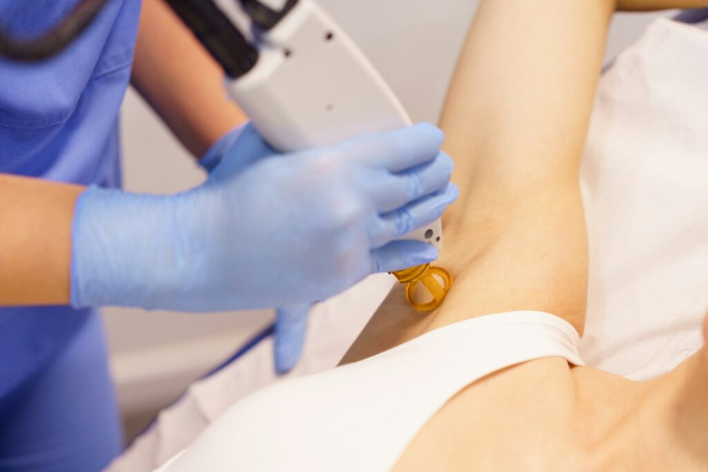 Woman receiving underarm laser hair removal at a beauty center.